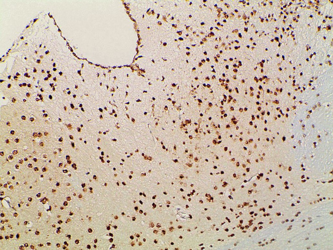 Ephrin B2 Antibody in Immunohistochemistry (Paraffin) (IHC (P))