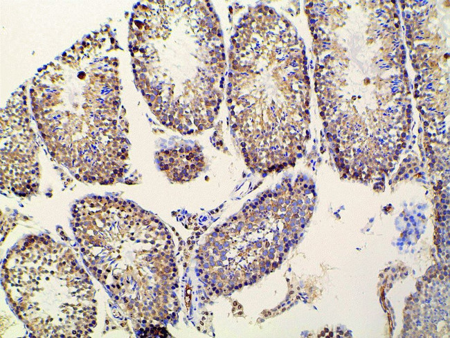 Ephrin B2 Antibody in Immunohistochemistry (Paraffin) (IHC (P))