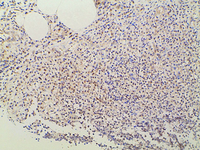 Ephrin B2 Antibody in Immunohistochemistry (Paraffin) (IHC (P))