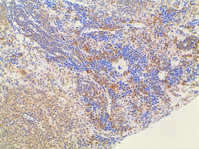 Ephrin B2 Antibody in Immunohistochemistry (Paraffin) (IHC (P))