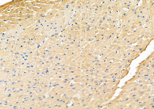 ZFYVE9 Antibody in Immunohistochemistry (Paraffin) (IHC (P))