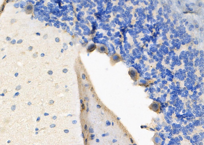 ZFYVE9 Antibody in Immunohistochemistry (Paraffin) (IHC (P))