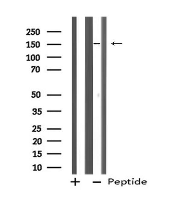 ZFYVE9 Antibody in Western Blot (WB)