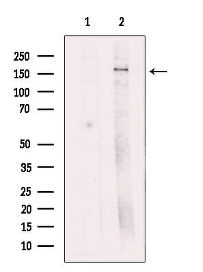 ZFYVE9 Antibody in Western Blot (WB)