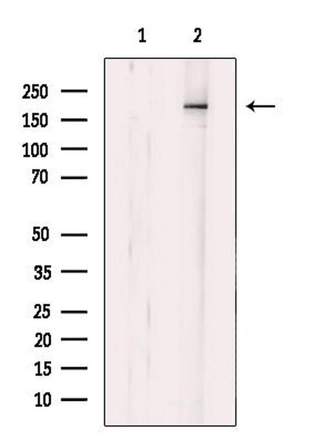 MIA3 Antibody in Western Blot (WB)