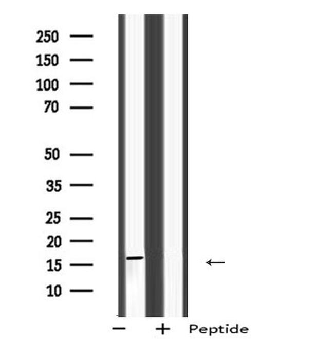 RT28 Antibody in Western Blot (WB)