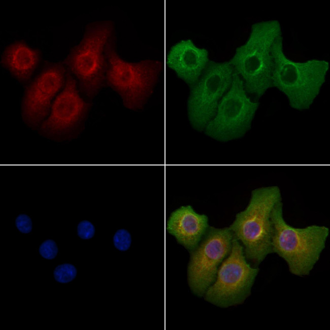 IMMP1L Antibody in Immunocytochemistry (ICC/IF)