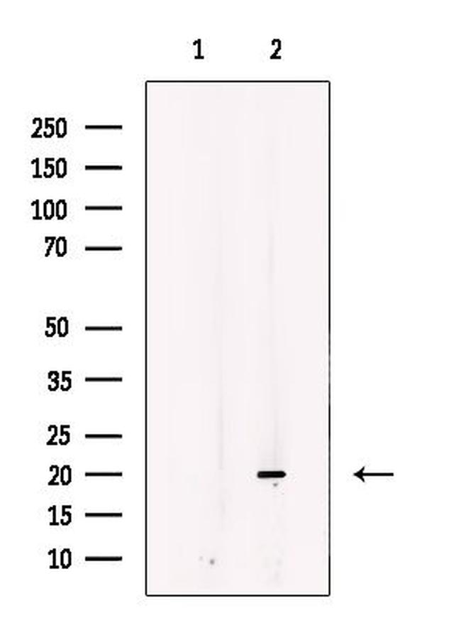 IMMP1L Antibody in Western Blot (WB)