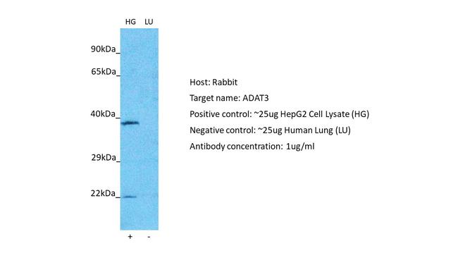 ADAT3 Antibody in Western Blot (WB)