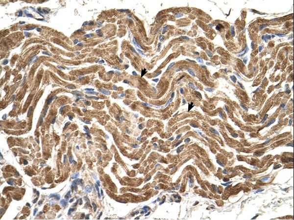 ATP Synthase beta Antibody in Immunohistochemistry (IHC)