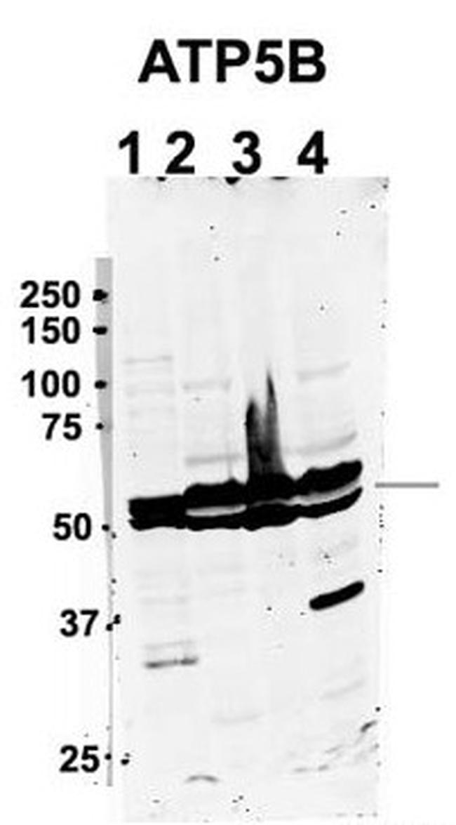 ATP Synthase beta Antibody in Western Blot (WB)