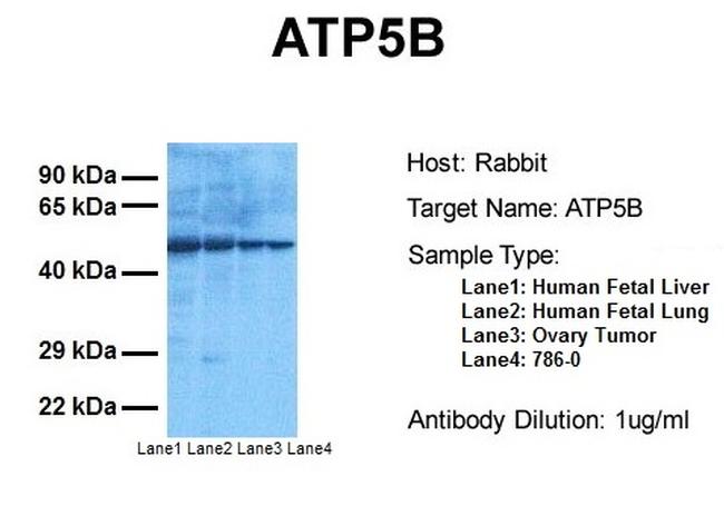 ATP Synthase beta Antibody in Western Blot (WB)