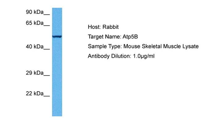 ATP Synthase beta Antibody in Western Blot (WB)