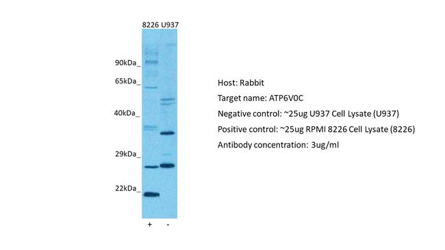 ATP6V0C Antibody in Western Blot (WB)