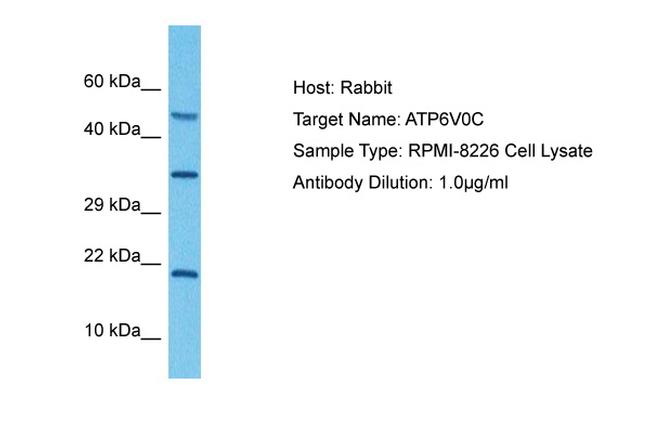 ATP6V0C Antibody in Western Blot (WB)