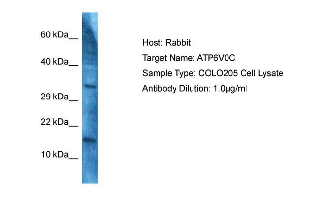 ATP6V0C Antibody in Western Blot (WB)