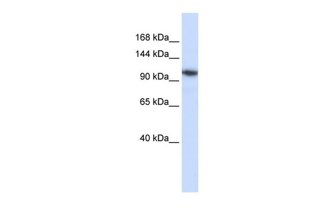 B4GALNT3 Antibody in Western Blot (WB)