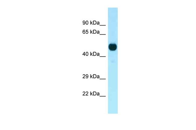 PFTK1 Antibody in Western Blot (WB)