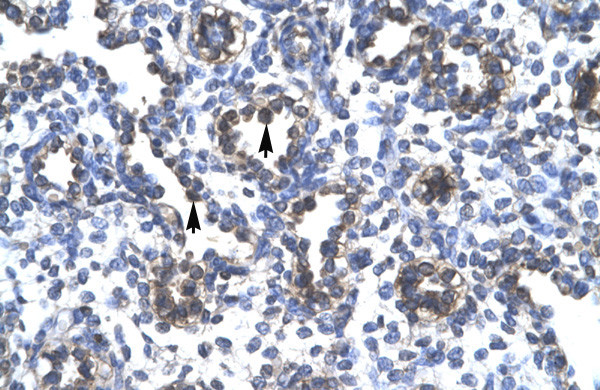 FOXA3 Antibody in Immunohistochemistry (IHC)