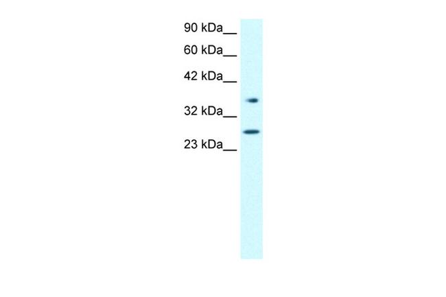 FOXA3 Antibody in Western Blot (WB)