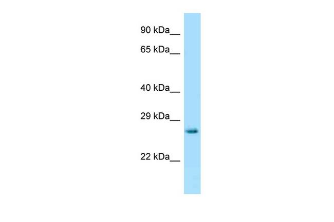 HPRT1 Antibody in Western Blot (WB)