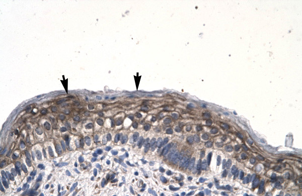 JMJD8 Antibody in Immunohistochemistry (IHC)