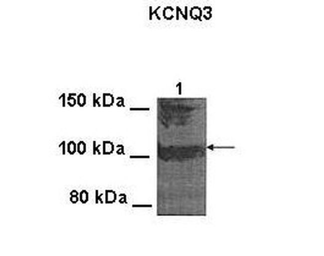 KCNQ3 Antibody in Western Blot (WB)