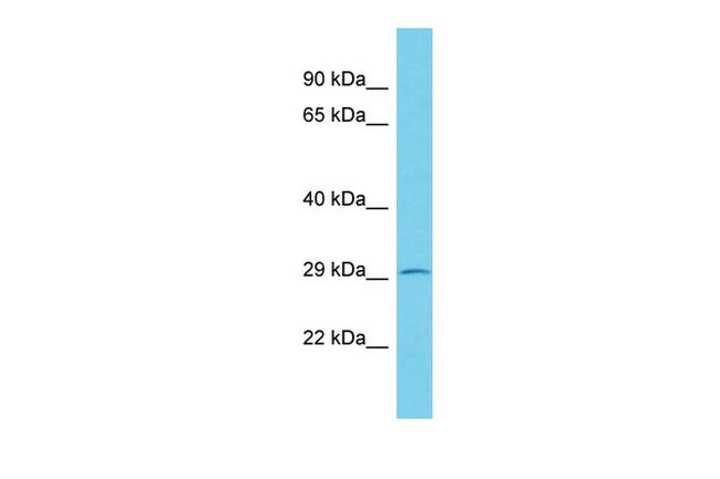 KCTD2 Antibody in Western Blot (WB)