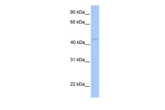 LIPT1 Antibody in Western Blot (WB)