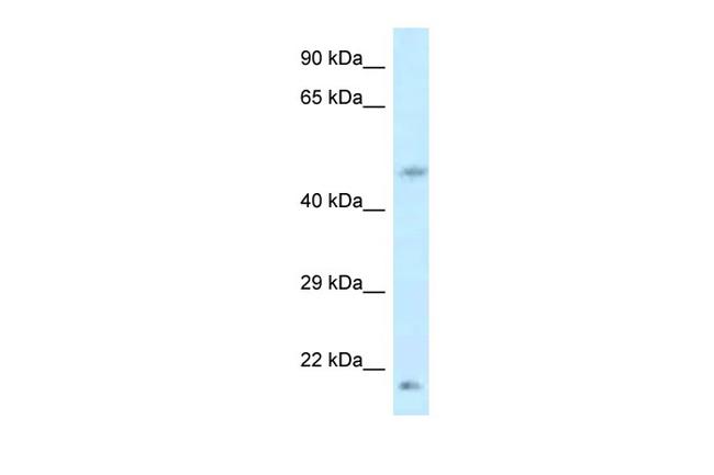 LOC100360413 Antibody in Western Blot (WB)