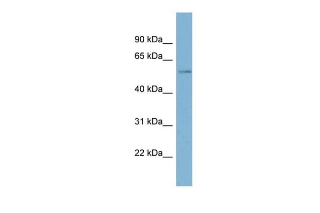 MARVELD2 Antibody in Western Blot (WB)