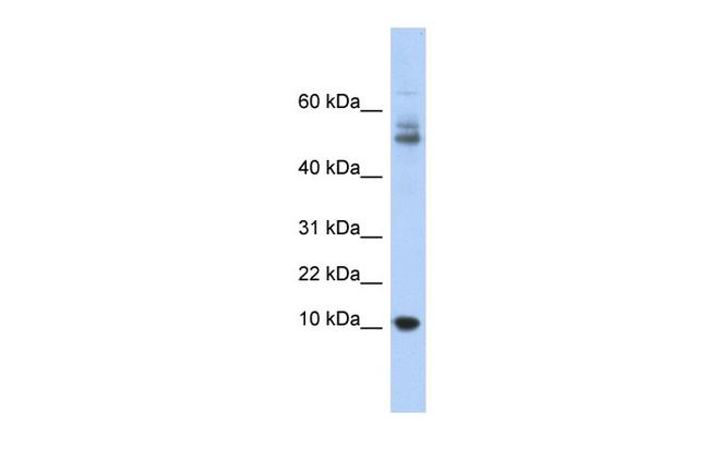 Myotrophin Antibody in Western Blot (WB)