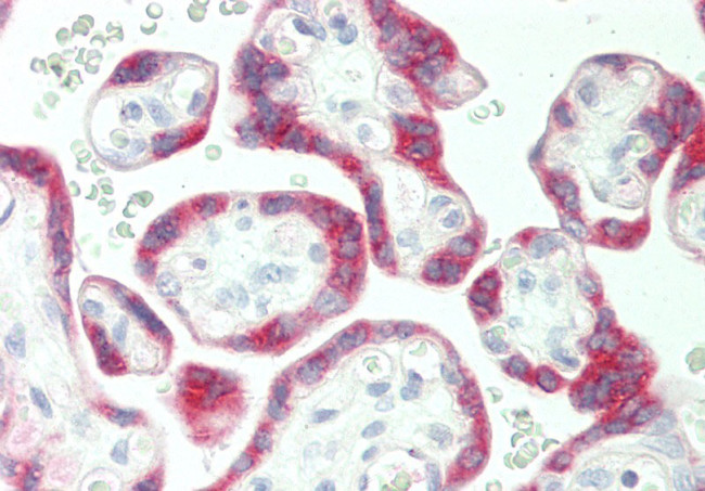 PSG5 Antibody in Immunohistochemistry (Paraffin) (IHC (P))