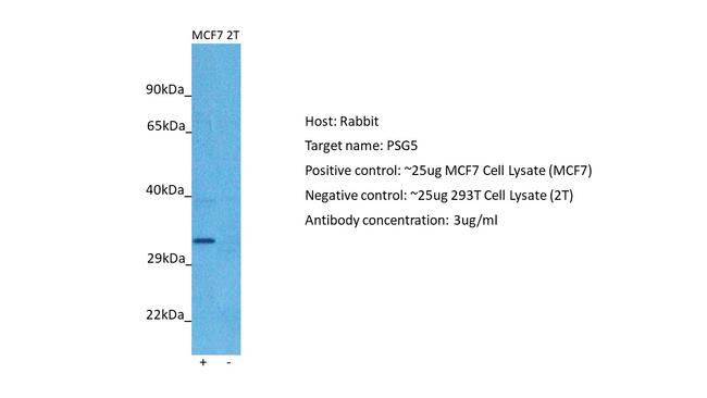 PSG5 Antibody in Western Blot (WB)