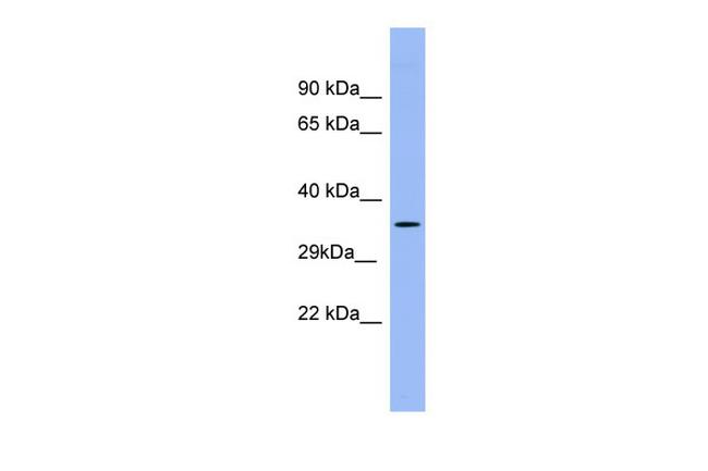 PSG5 Antibody in Western Blot (WB)