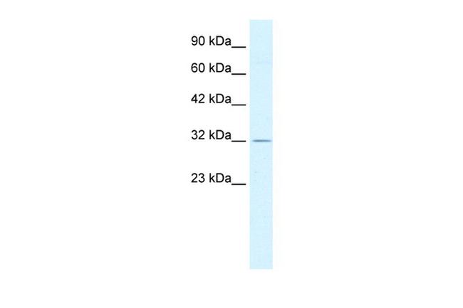 PSMD14 Antibody in Western Blot (WB)