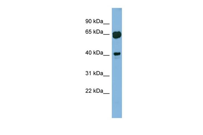 RAB3IL1 Antibody in Western Blot (WB)