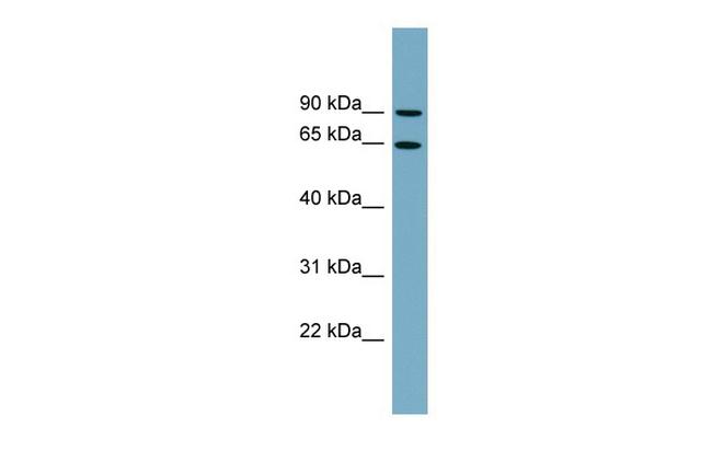 SLC12A8 Antibody in Western Blot (WB)