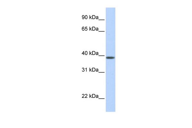 SLC25A42 Antibody in Western Blot (WB)