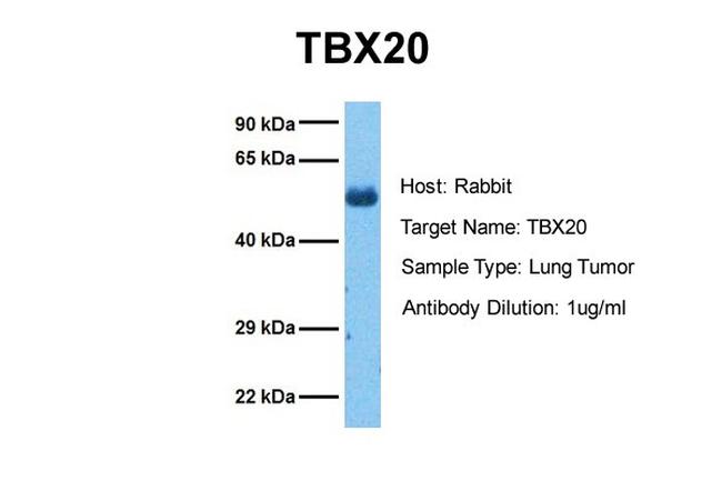 TBX20 Antibody in Western Blot (WB)