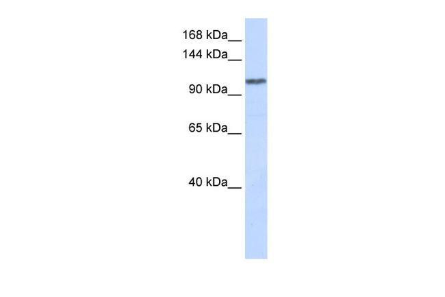 WDR63 Antibody in Western Blot (WB)