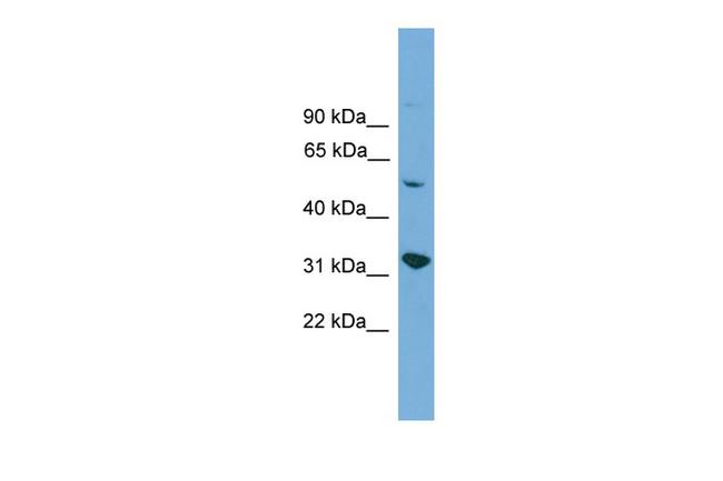 YIPF2 Antibody in Western Blot (WB)