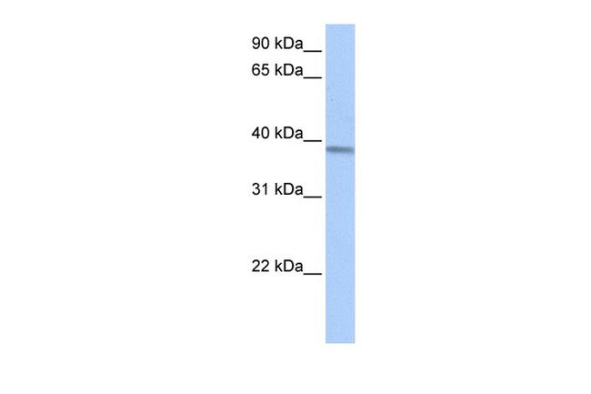 SBCAD Antibody in Western Blot (WB)