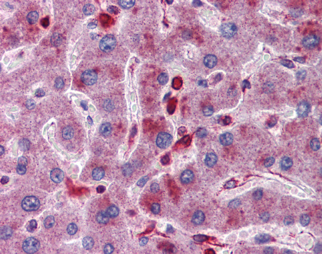 Acid Phosphatase 2 Antibody in Immunohistochemistry (IHC)