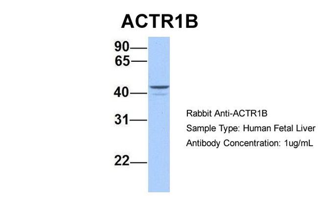 ACTR1B Antibody in Western Blot (WB)