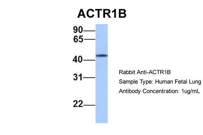 ACTR1B Antibody in Western Blot (WB)