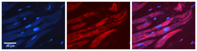 ALAD Antibody in Immunohistochemistry (IHC)