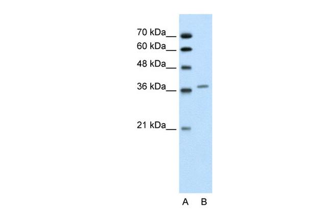 ALAD Antibody in Western Blot (WB)