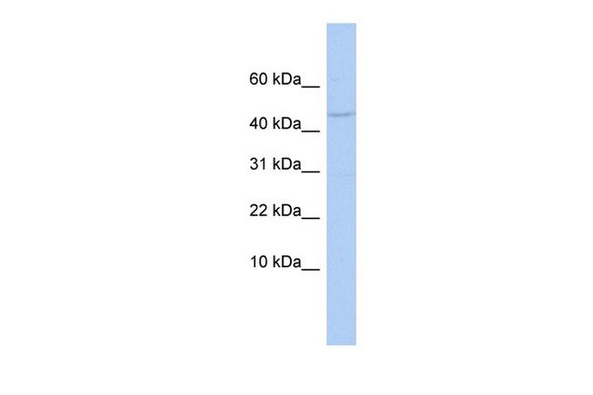 APOBEC3F Antibody in Western Blot (WB)