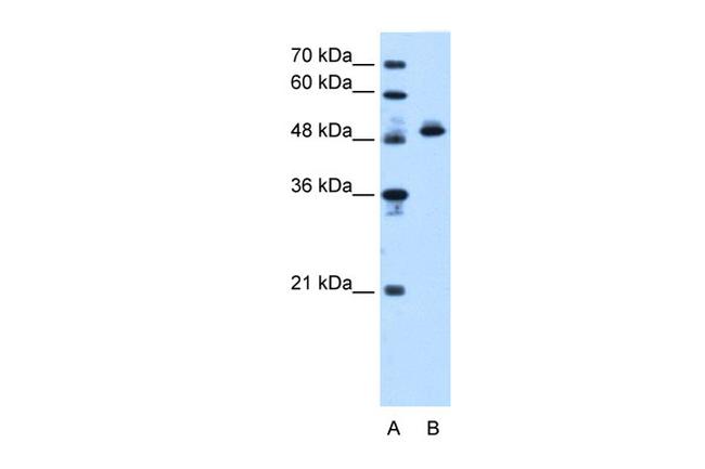 ATP Synthase beta Antibody in Western Blot (WB)